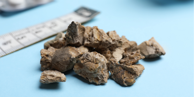 Our Top Tips to Prevent Kidney Stones + How Sugar Skyrockets Your Risk