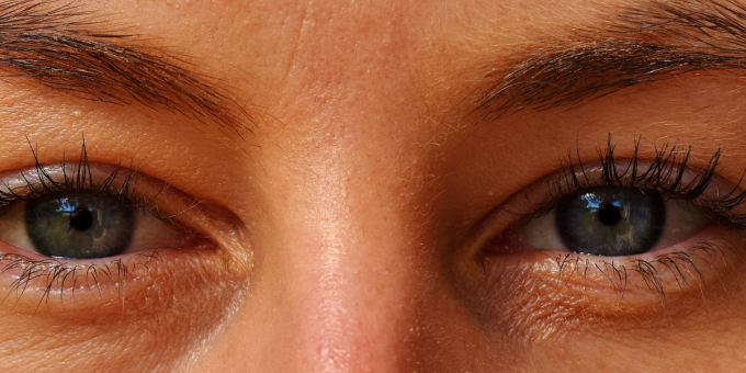 3 Ways Liver Disease Shows Up On Your Face