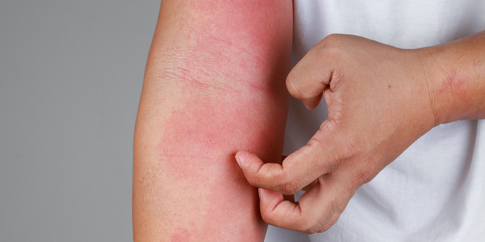 9 Signs Your Lymphatic System Needs a Boost