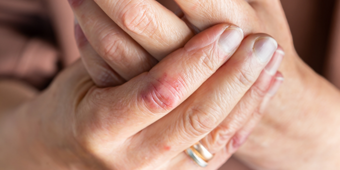 3 Important Pillars of Health Influenced by Your Gut