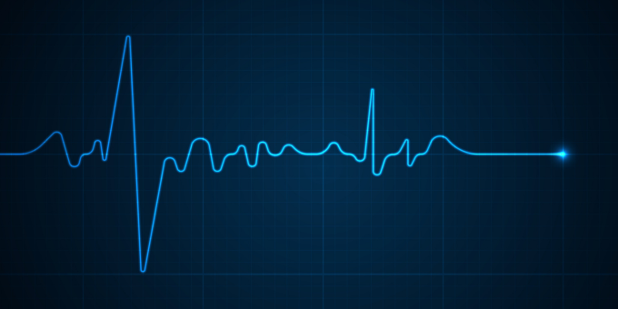 How to Spot a Silent Heart Attack