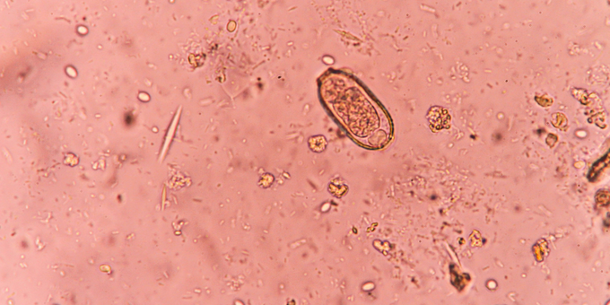 Why You Might Have Intestinal Parasites