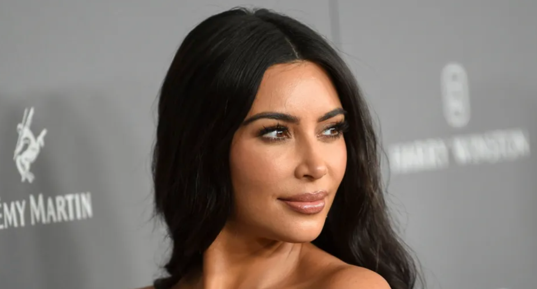 Kim Kardashian’s Journey Through Psoriasis + The Warning Signs