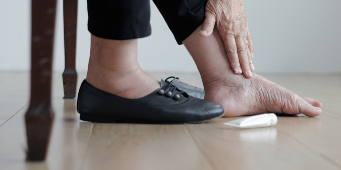 The Surprising Causes of Lymphedema